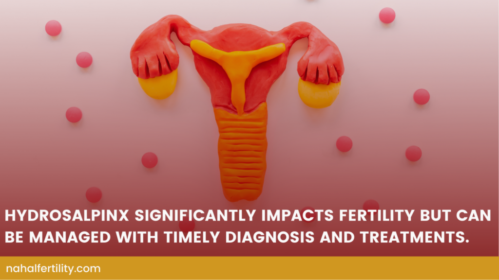 Addressing hydrosalpinx before undergoing fertility treatments significantly improves the likelihood of pregnancy success