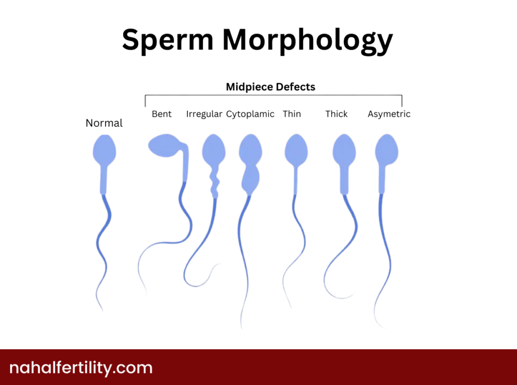 Healthy sperm cells typically have an oval head and a sturdy tail. Abnormalities of sperm—like a misshapen head or multiple tails—can hinder fertilization potential. A high percentage of typical forms is beneficial. In the following picture, you can see some types of defects in sperm morphology. 