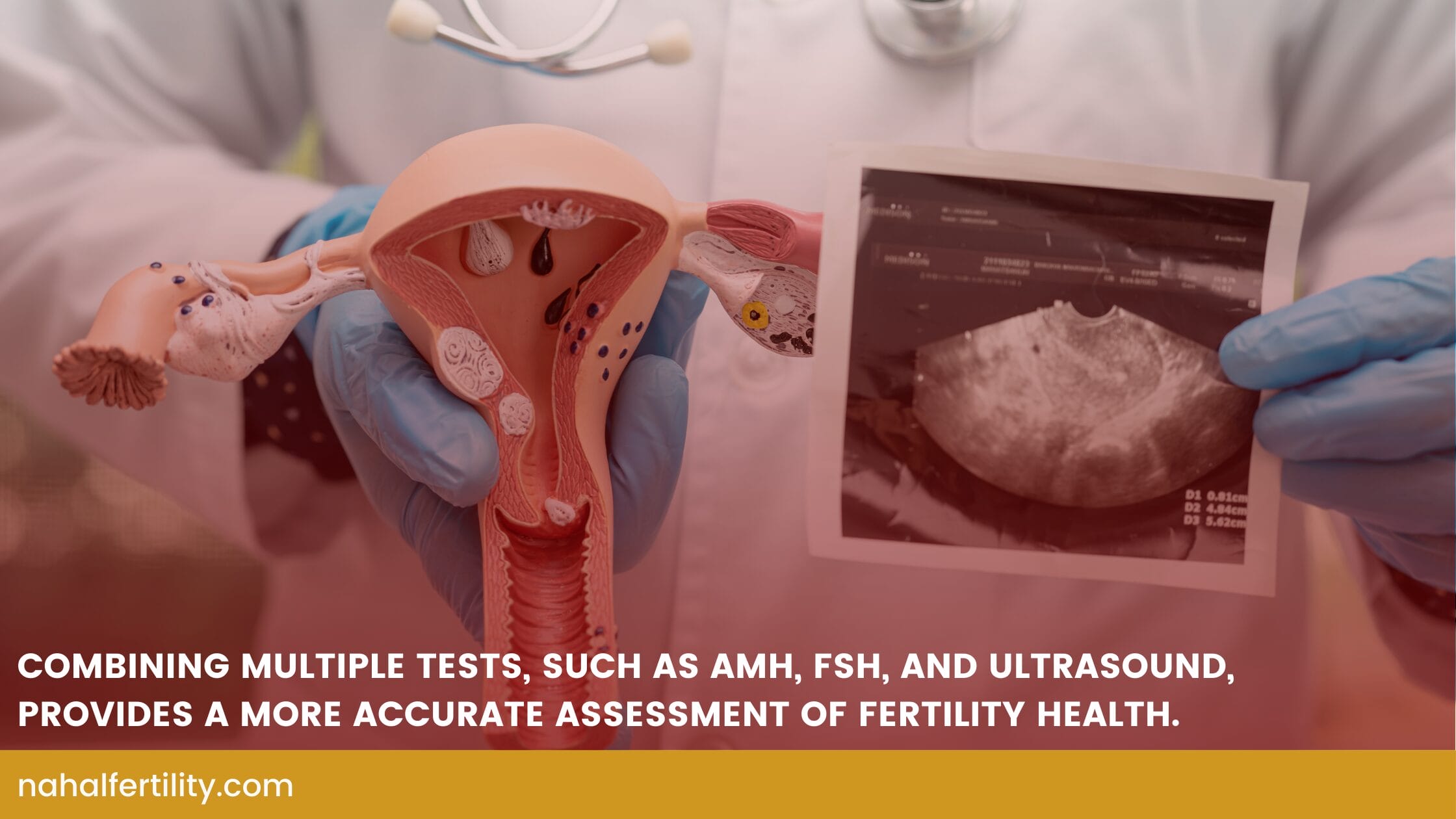 Combining multiple tests, such as AMH, FSH, and ultrasound, provides a more accurate assessment of fertility health.