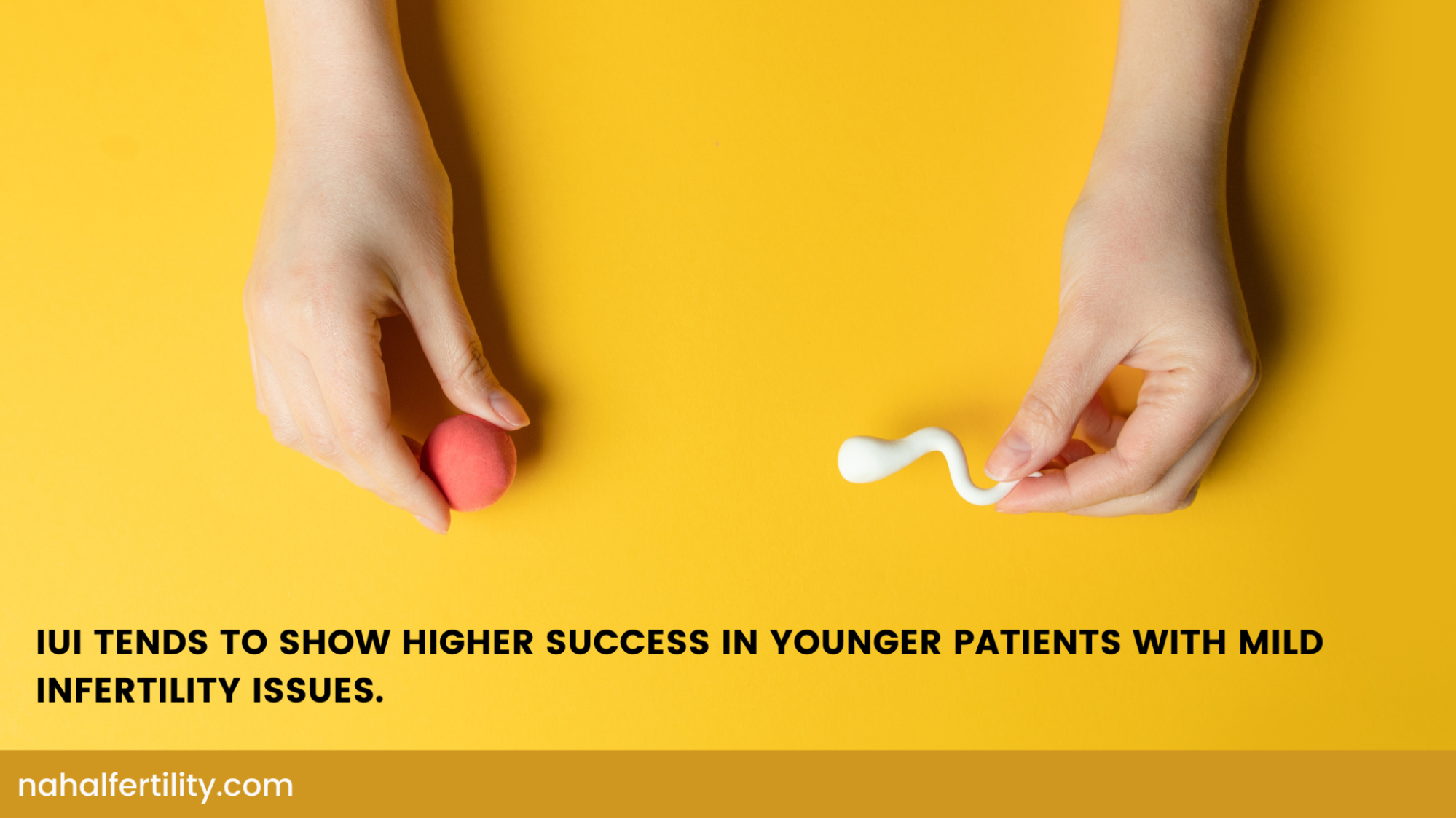 IUI tends to show higher success in younger patients with mild infertility Issues.